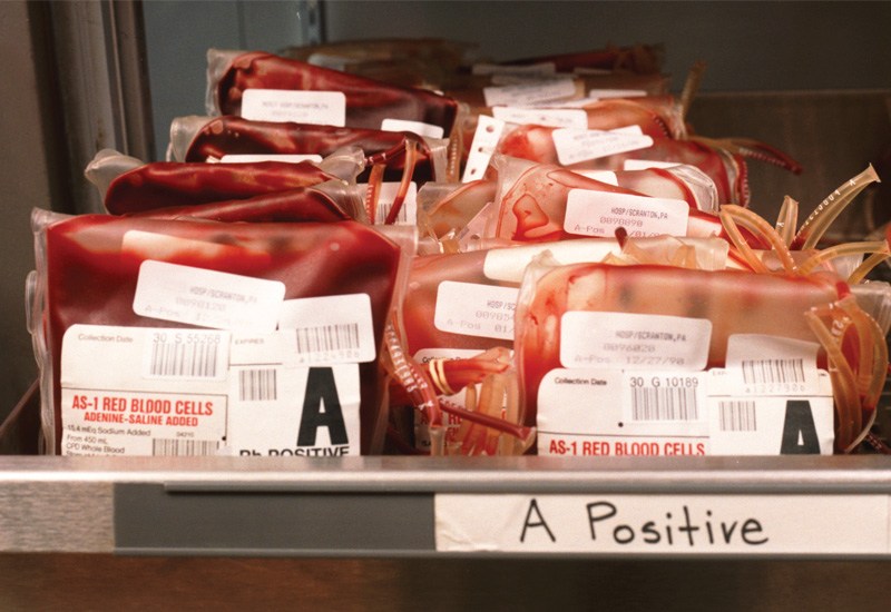 Wie Sie Ihre Blutkonserven unter optimalen Bedingungen aufbewahren